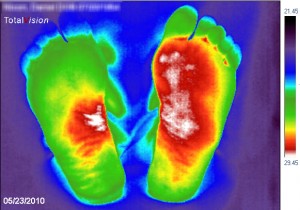 onsteking candida thermografie