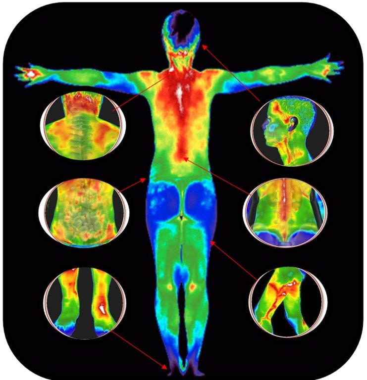 medical-thermography